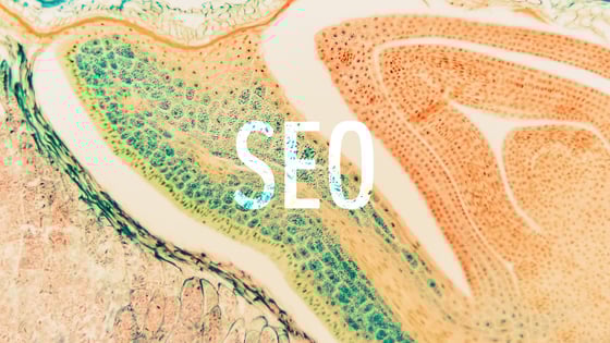 An Easy Guide to the Science of SEO Friendly URLS